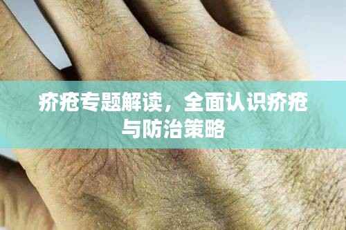 疥疮专题解读,全面认识疥疮与防治策略